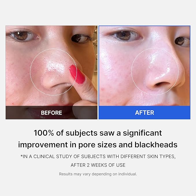 منظفات قطنية للمسام واللرؤوس السوداء والبيضاء | (70pcs) Medicube Zero Pore Pad