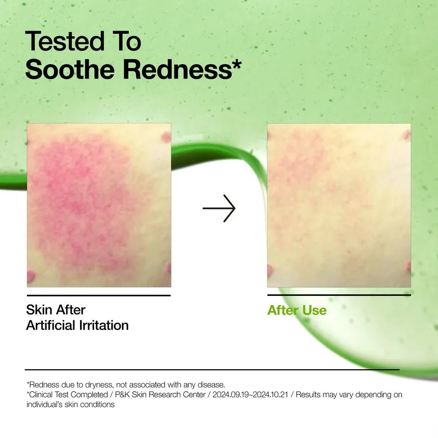 ANUA AZELAIC ACID 10 HYALURON REDNESS SOOTHING SERUM - 30ML | أنوا سيروم الآزليك اسيد المهدئ للبشرة - ٣٠ مل 30 مل - EROS STORE
