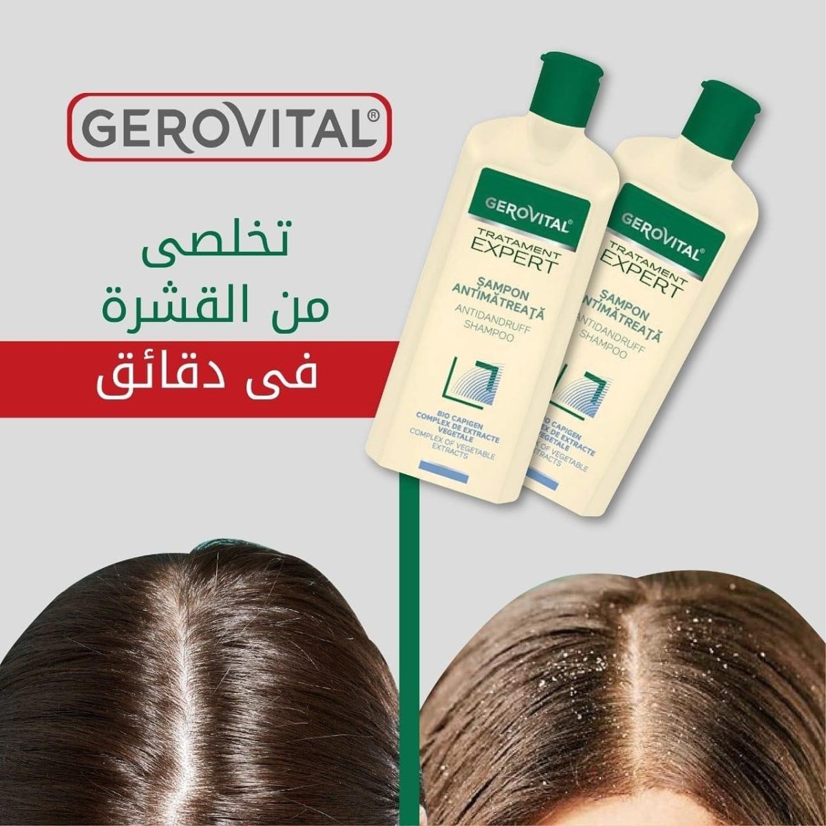 شامبو معالج للقشرة والحكة من جيروفيتال | Gerovital Anti - Dandruff & Itch Shampoo 250 مل - EROS STORE