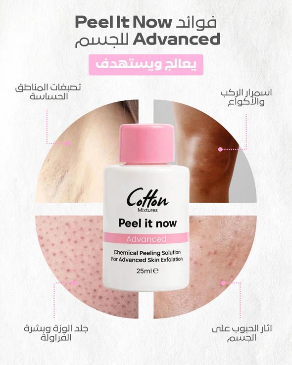 cotton peel it now advanced - body peel | قطن محلول تقشير الجسم المركز 25 مل - EROS STORE