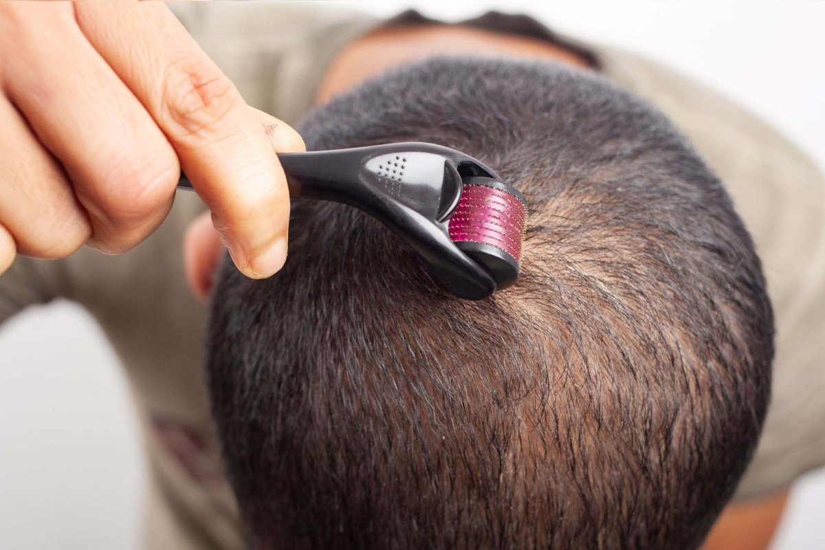 جهاز ديرمارول تيتانيوم لإعادة بناء البشرة | Titanium Derma Roller 0.5 MM - EROS STORE