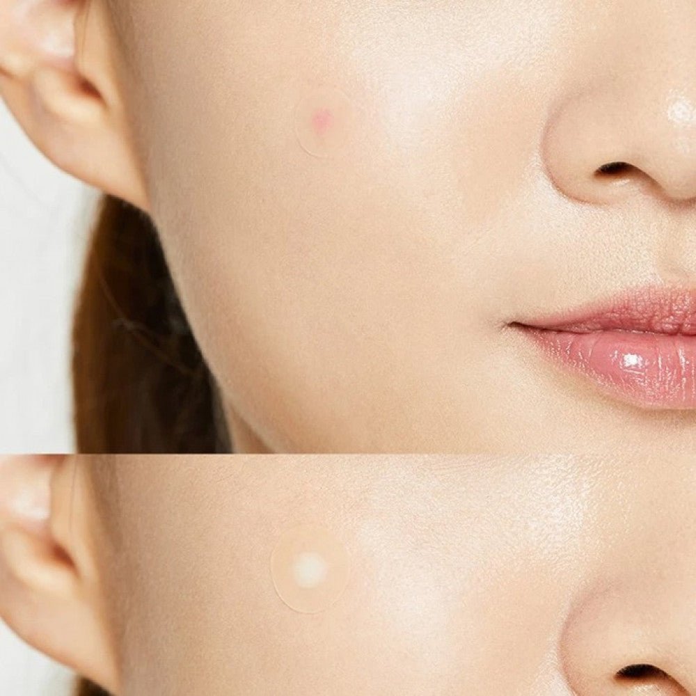 رقعة علاج حب الشباب والبثور من كوزركس | COSRX Acne Pimple Master Patch 24 رقعة - EROS STORE