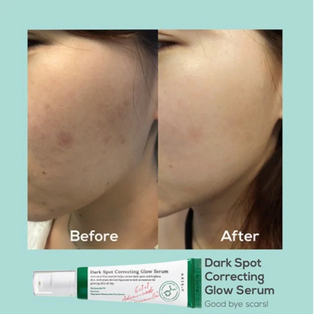 سيروم مصحح للتصبغات من أكسس - واي | AXIS - Y Dark Spot Correcting Glow Serum - 50ml 50 مل - EROS STORE